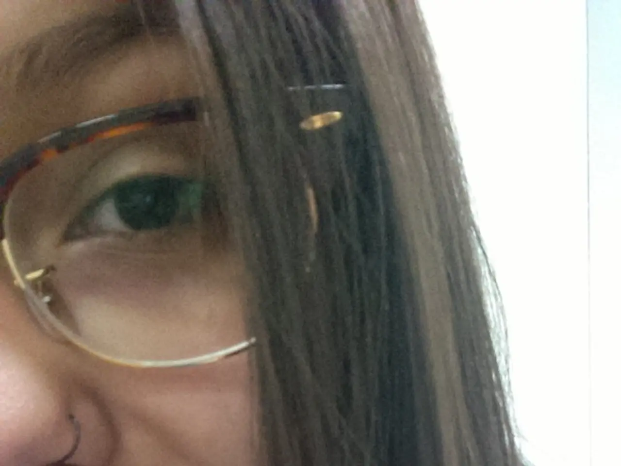 Artificial Lens Implantation (Intraocular Lens): Explanation, potential indicators, and varieties