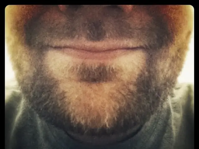 Acne Comedonica: Classification, Representative Images, and Therapeutic Strategies