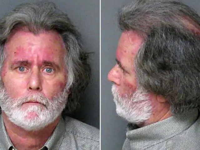 Actor Bruce Willis experiences loss of recognition regarding his prior roles and career milestones.