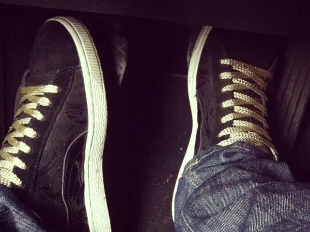 Foot pain and joint inflammation due to rheumatoid arthritis: Indications and remedies