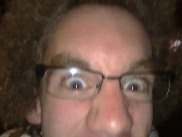 Cosmetic specialist sheds light on Lucas's nose bandage usage.