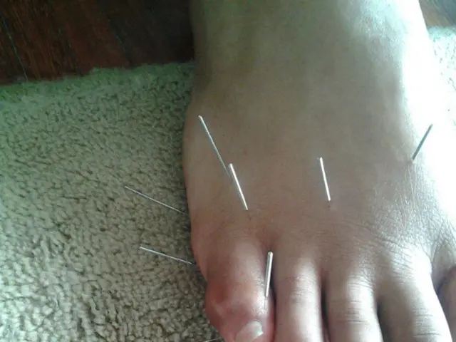 Angiography and Angioplasty: A Comparison and Explanation